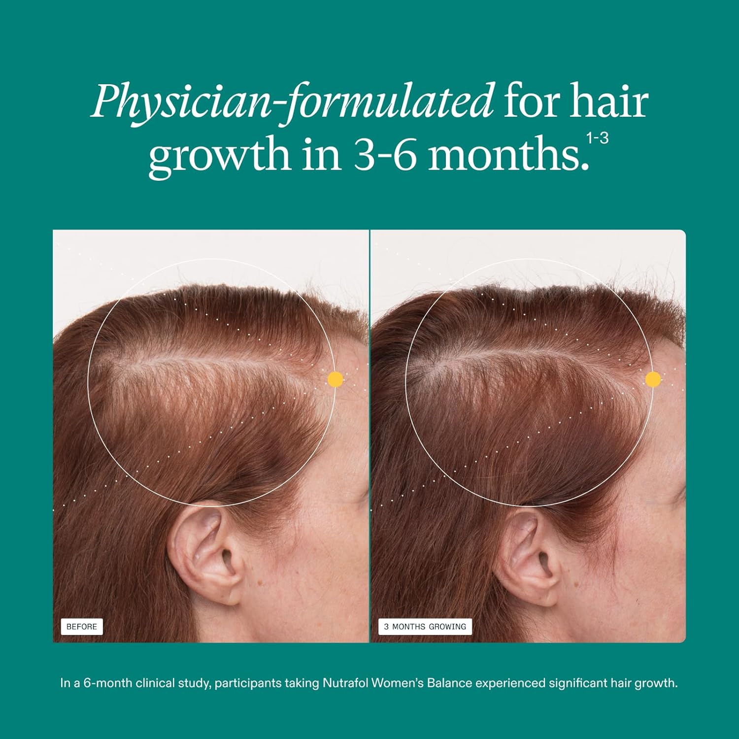 Nutrafol Women's Balance Hair Growth Supplements, Clinically Proven for Visibly Thicker Hair and Scalp Coverage