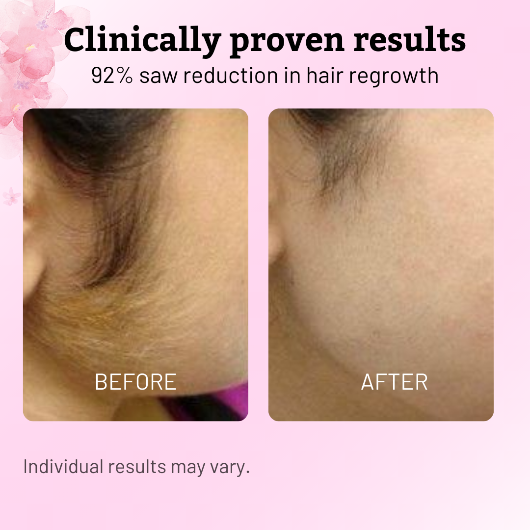 Caramela Beauty Cyperus Rotundus Oil for Natural Permanent Hair Reduction-Shop