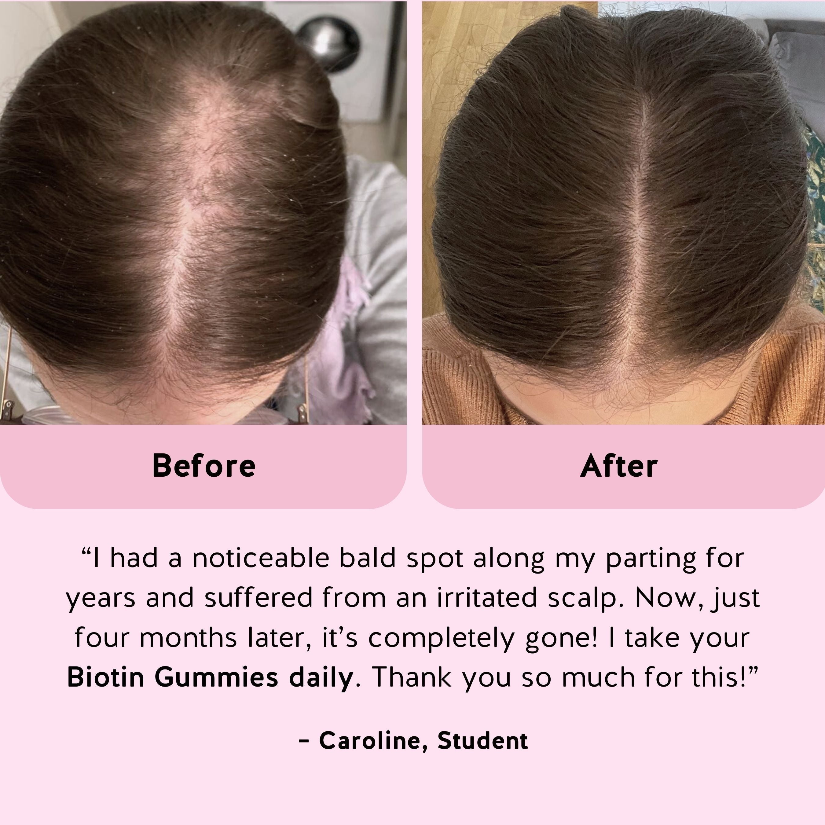 Ah-Mazing Hair Vitamins